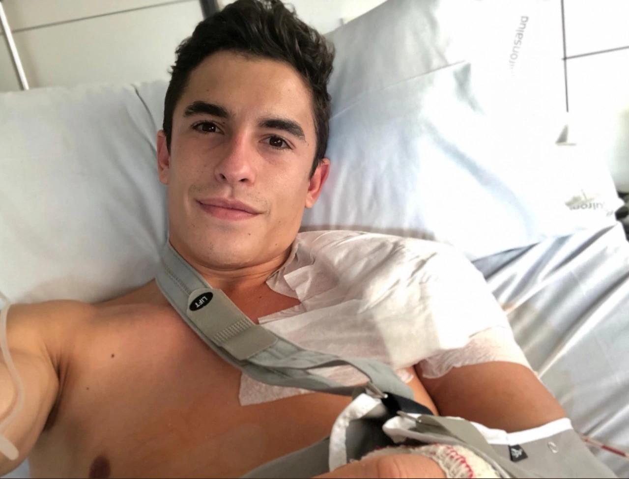 Marc Marquez setelah operasi